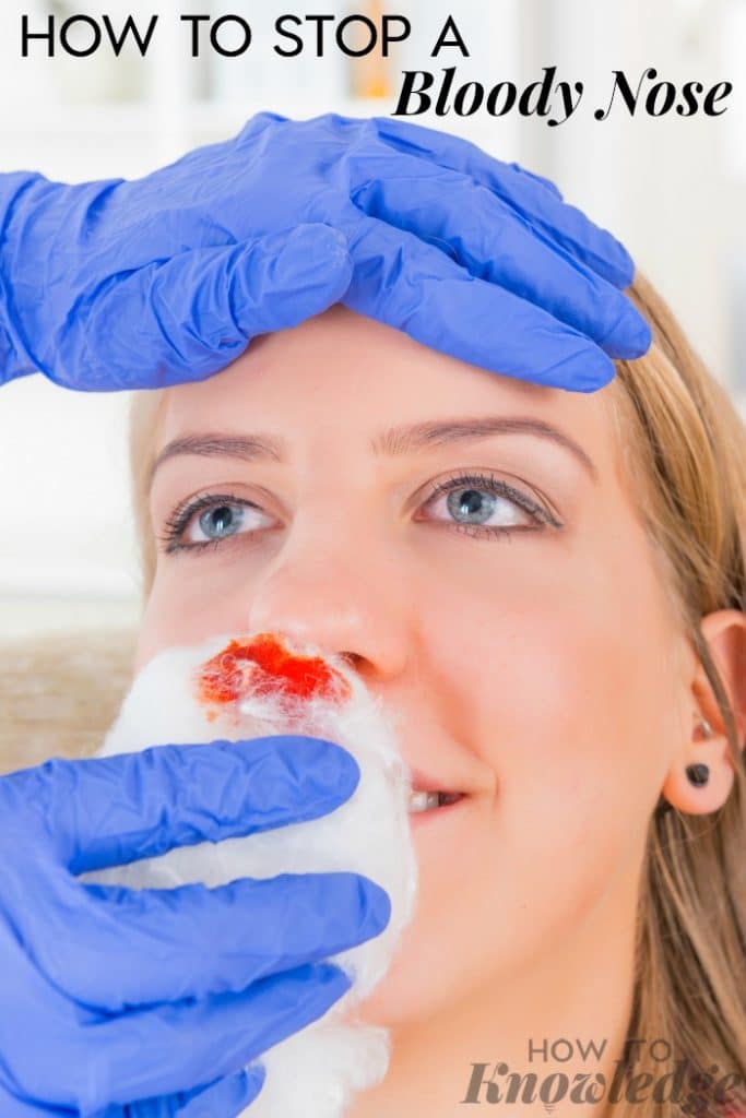 How to Stop a Bloody Nose