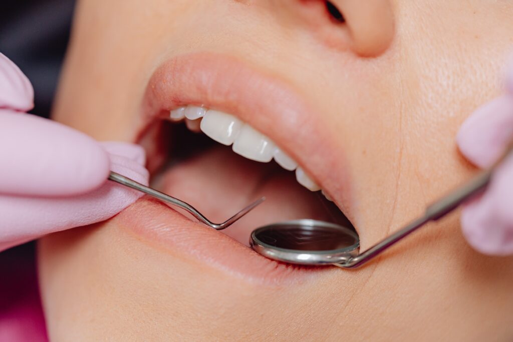 woman getting teeth examined